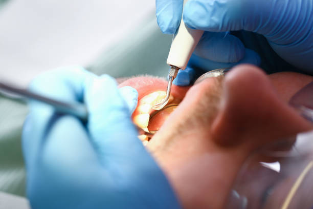 Best Emergency Tooth Extraction  in Tresckow, PA