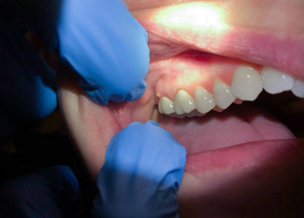 Best Emergency Gum Pain Relief  in Tresckow, PA