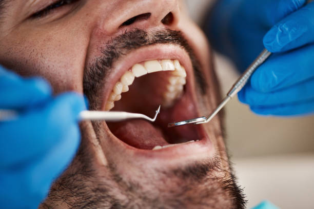 Best Dentist for Tooth Abscess  in Tresckow, PA