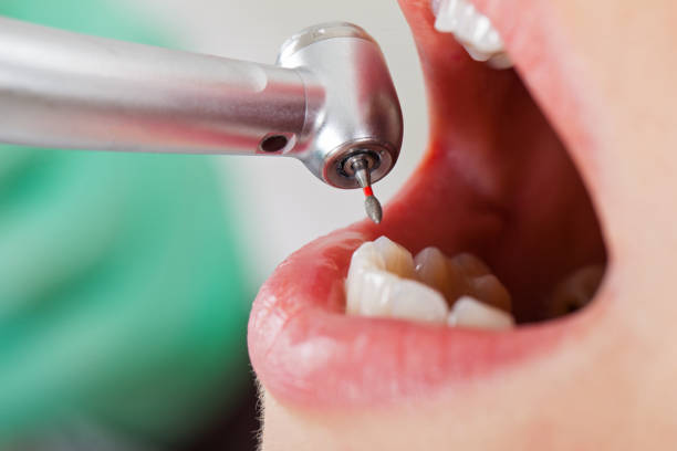 Best Root Canal Emergency Dentist  in Tresckow, PA